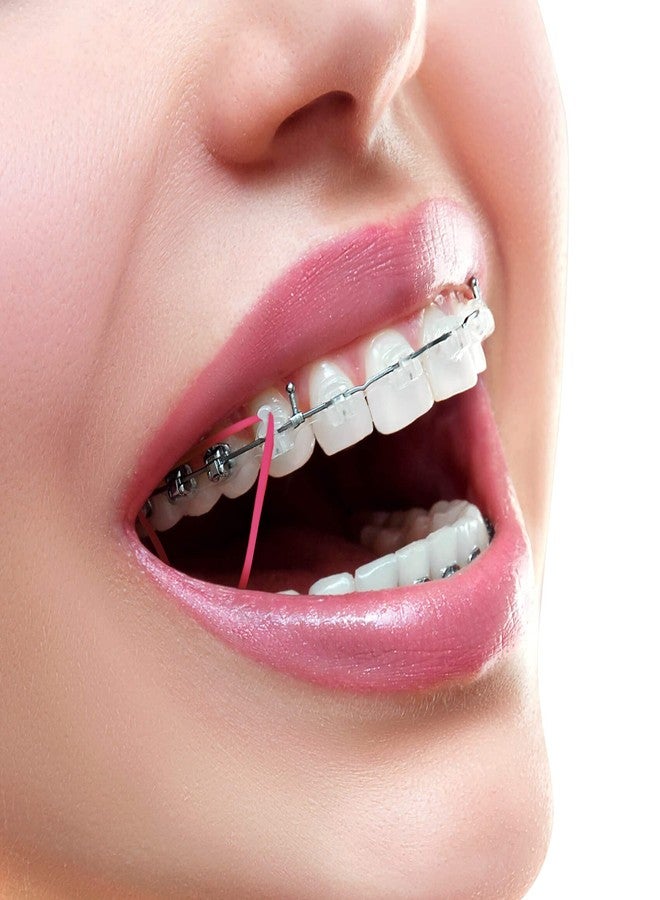 أربطة مطاطية مرنة لتقويم الأسنان من آنهوا، 500 قطعة، 3/16 بوصة، 4.5 أونصة، أربطة مطاطية لملء الفراغات بين الأسنان، ولتصفيف شعر الكلاب، والضفائر، والشعر المضفر - نيون - Image 5