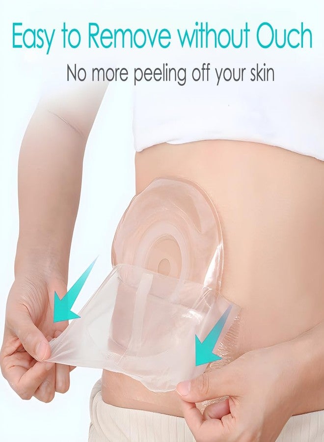 DiaBelt 10" x 10" Ostomy Shower Cover [Pack of 25], Ostomy Bag Shower Protector Stoma Shower Guard Colostomy Shower Shields Waterproof Bandage for Women Men Showering - Image 2