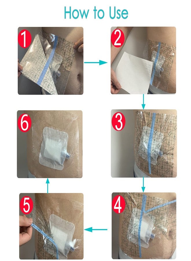 DiaBelt 10" x 10" Ostomy Shower Cover [Pack of 25], Ostomy Bag Shower Protector Stoma Shower Guard Colostomy Shower Shields Waterproof Bandage for Women Men Showering - Image 5