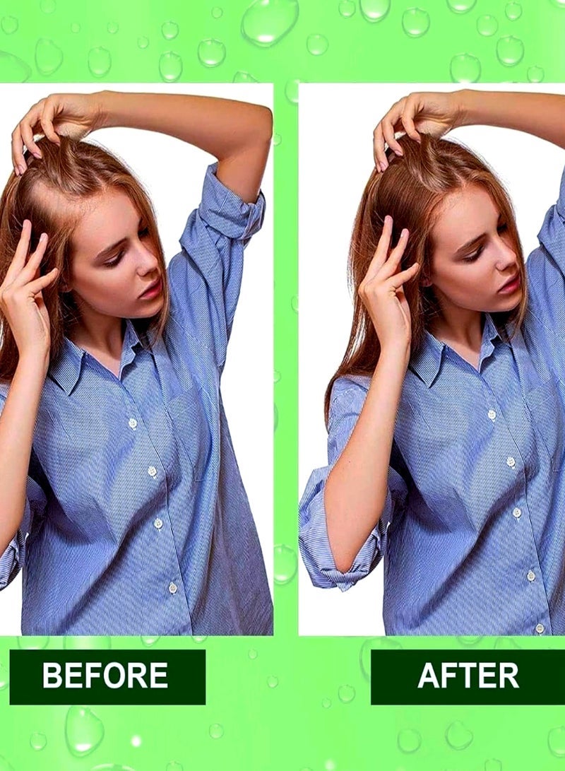 ALIVER Rosemary Oil ( 30 ML x 2 ) Essential Oil , Aliver Rosemary Oil For Hair Growth Pure Organic Aliver Rosemary Oil For Hair , Dry Damaged Hair and Growth Hair Scalp Oil Pure and Natural Premium Quality Oil Hair Loss Treatment Oil for Men and Women - Image 5