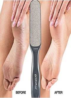 Double Sided Multidirectional Nickel Foot File Callus Remover Immediately Reduces Calluses And Corns To Powder For Instant Results, Safe Tool (Dark Grey) - pzsku/ZFFFD7462FF9E0DBED87BZ/45/_/1647802748/cb7f00d7-3e22-4786-bb3e-e1f4d0231226