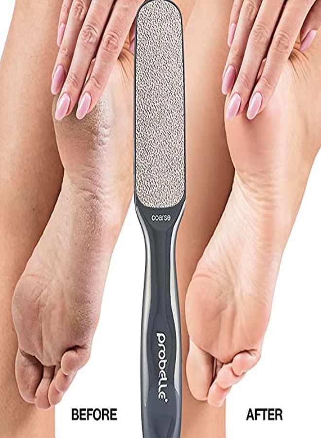 Probelle Double Sided Multidirectional Nickel Foot File Callus Remover Immediately Reduces Calluses And Corns To Powder For Instant Results, Safe Tool (Dark Grey) - Image 4