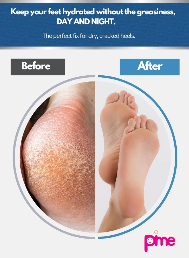 PIME Foot Care Cream 100g x2 | Intensive Moisturizing Cream with Urea & Shea Butter | Repairs Cracked Heels, Dry & Rough Feet | Deep Hydration with Natural Ingredients - Image 4