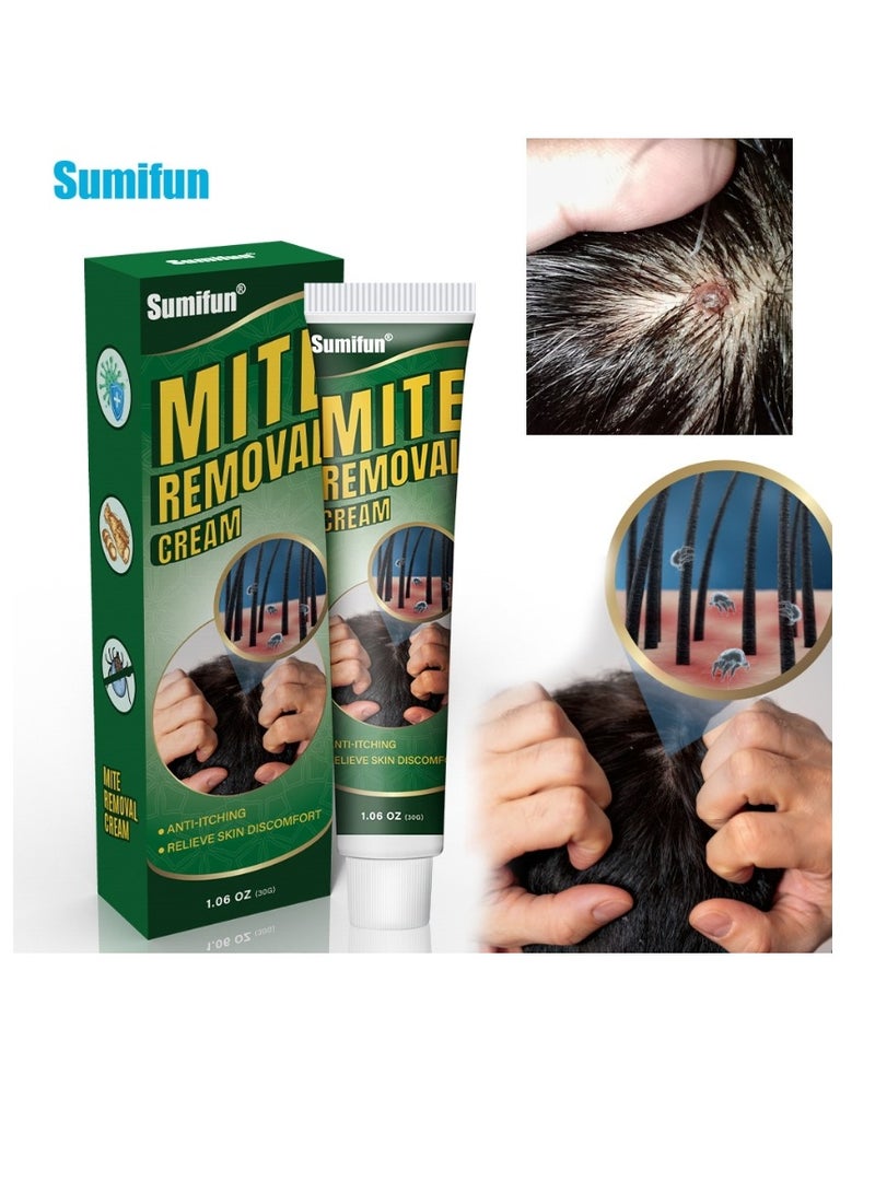 سوميفون كريم إزالة العث - كريم مضاد للحكة لالتهاب الجريبات والتهاب الجلد والقشرة والعث والحكة وفروة الرأس المتقشرة، يعالج القشرة والتهاب الجلد الدهني 30 جم - Image 1