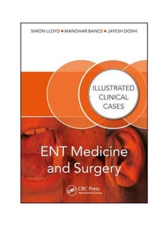 Ent Medicine And Surgery: Illustrated Clinical Cases Paperback English by Simon Kinglsey Wickham Lloyd - 2018 