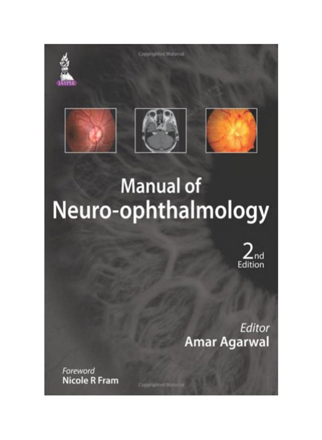 Manual Of Neuro-ophthalmology Paperback English by Amar Agarwal - 31-May-15 