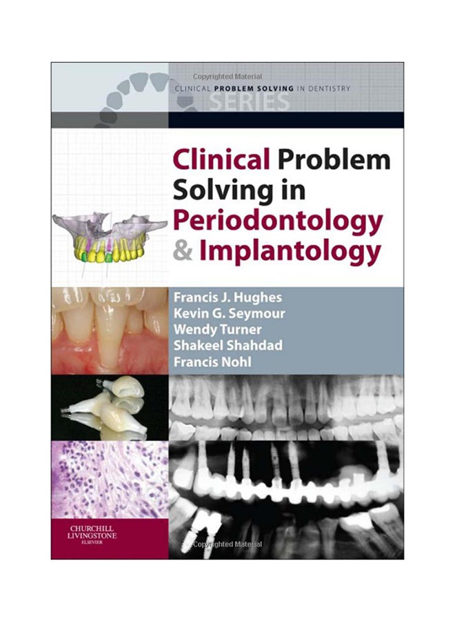 Clinical Problem Solving In Periodontology And Implantology Paperback English by Francis J. Hughes - 11/13/2012 