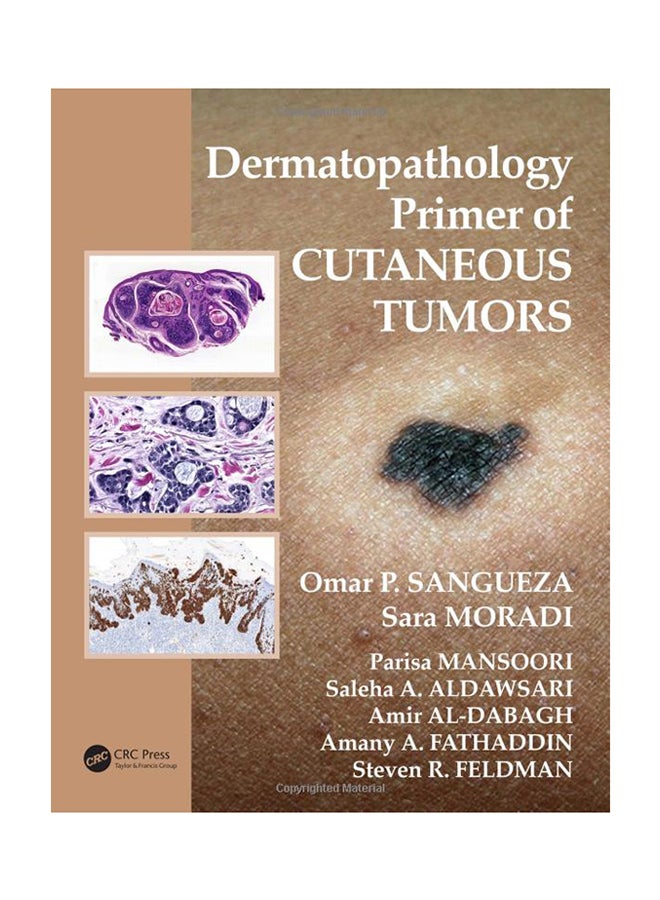 Dermatopathology Primer Of Cutaneous Tumors Paperback English by Omar P. Sangueza - 21-Jul-15 