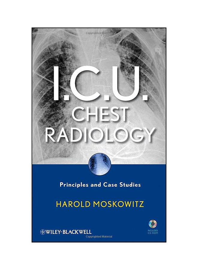 I.C.U. Chest Radiology: Principles And Case Studies Hardcover English by Harold Moskowitz - 12-Apr-10 