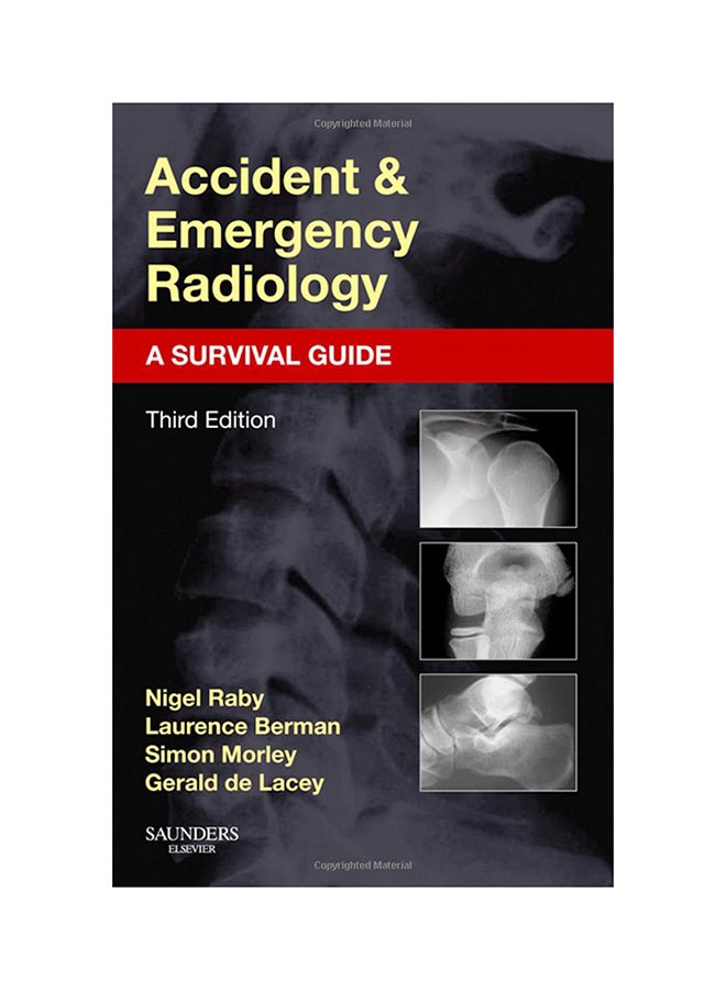 Accident And Emergency Radiology: A Survival Guide Paperback English by Nigel Raby - 4-Jun-15 