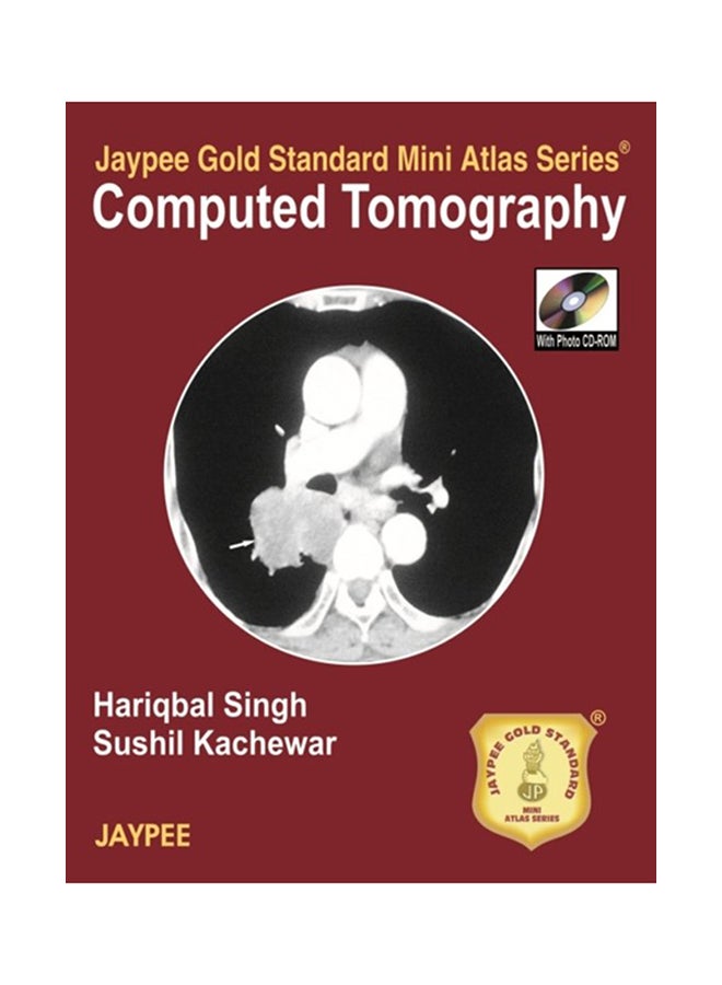Computed Tomography Paperback English by Hariqbal Singh - 19-Nov-10