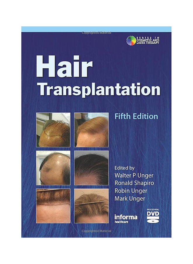 زراعة الشعر غلاف صلب الإنجليزية - 17-Dec-10