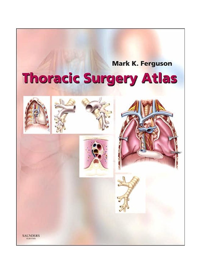 Thoracic Surgery Atlas Hardcover English by Mark K. Ferguson - 19-Sep-11 