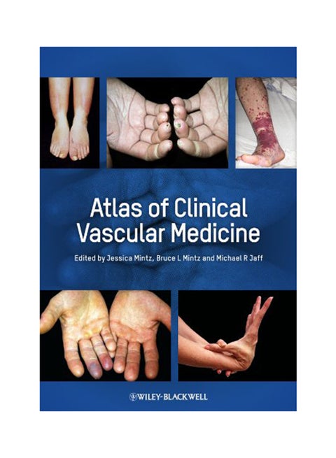 أطلس الطب الوعائي السريري غلاف ورقي الإنجليزية - 13-May-13