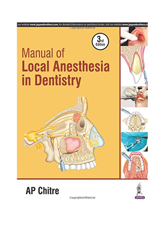 Manual Of Local Anaesthesia In Dentistry Paperback English by A. P. Chitre - 29-Feb-16 - Image 1