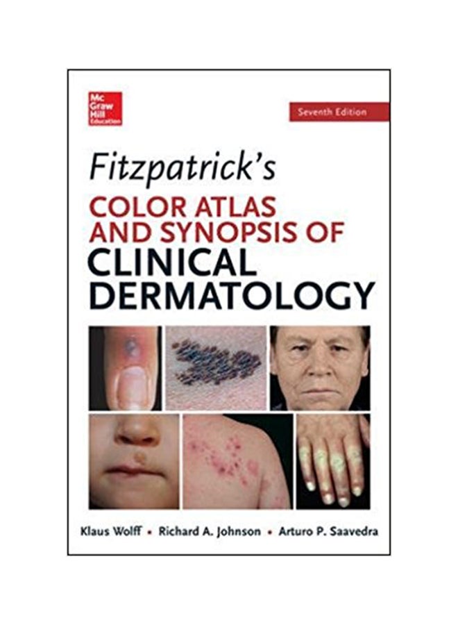 Fitzpatrick's Color Atlas And Synopsis Of Clinical Dermatology Paperback English by Richard Allen Johnson - 3-Jun-13 