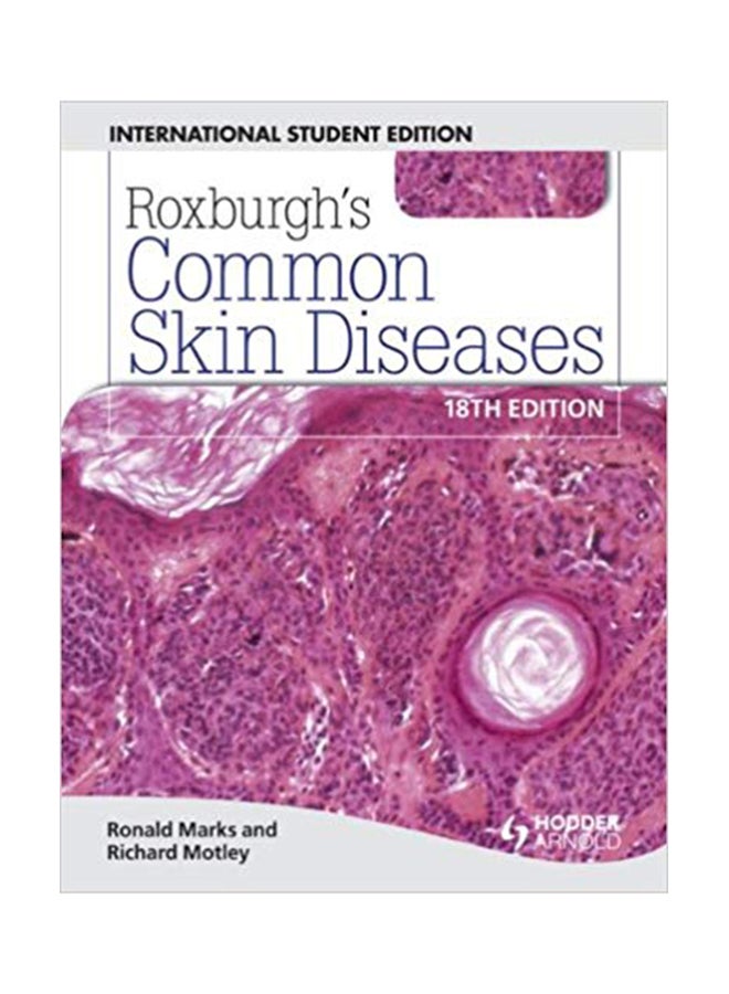 Roxburgh's Common Skin Diseases Paperback English by Ronald Marks - 26 Nov 2010 