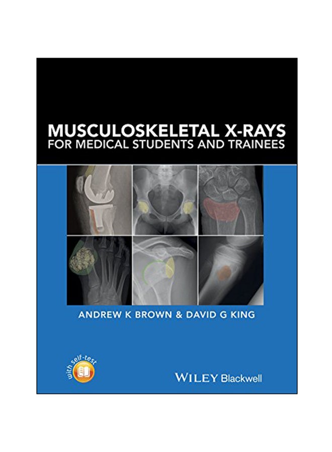 Musculoskeletal X-Rays For Medical Students And Trainees paperback english - 06 Sep 2016 