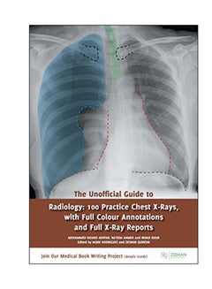 The Unofficial Guide To Radiology Paperback English - 04 Apr 2017