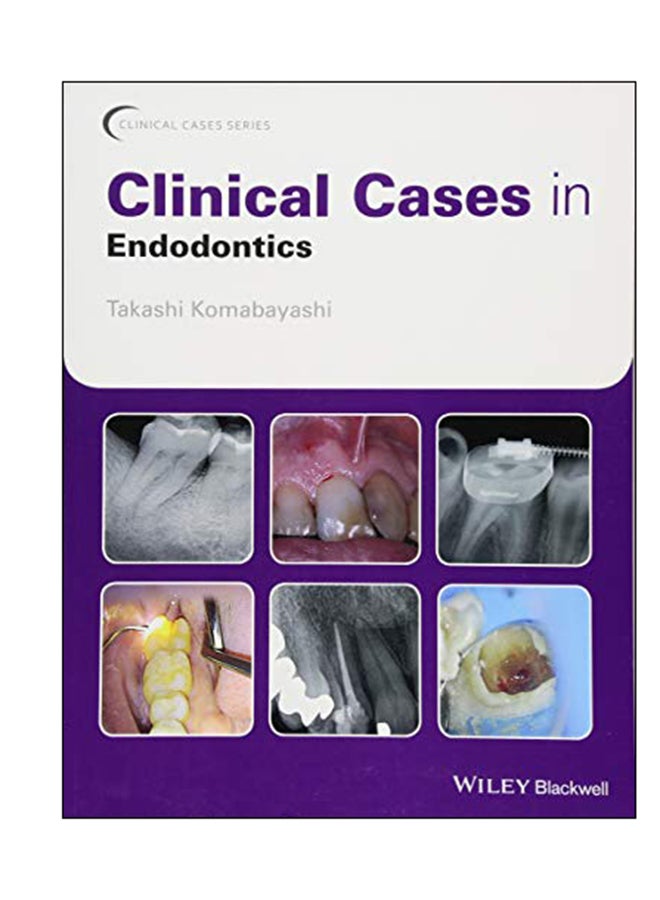 Clinical Cases In Endodontics paperback english - 28 Feb 2018 