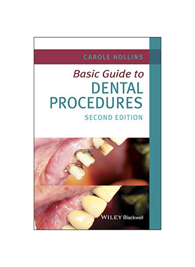 Basic Guide to Dental Procedures Paperback English by Carole Hollins - 2015 