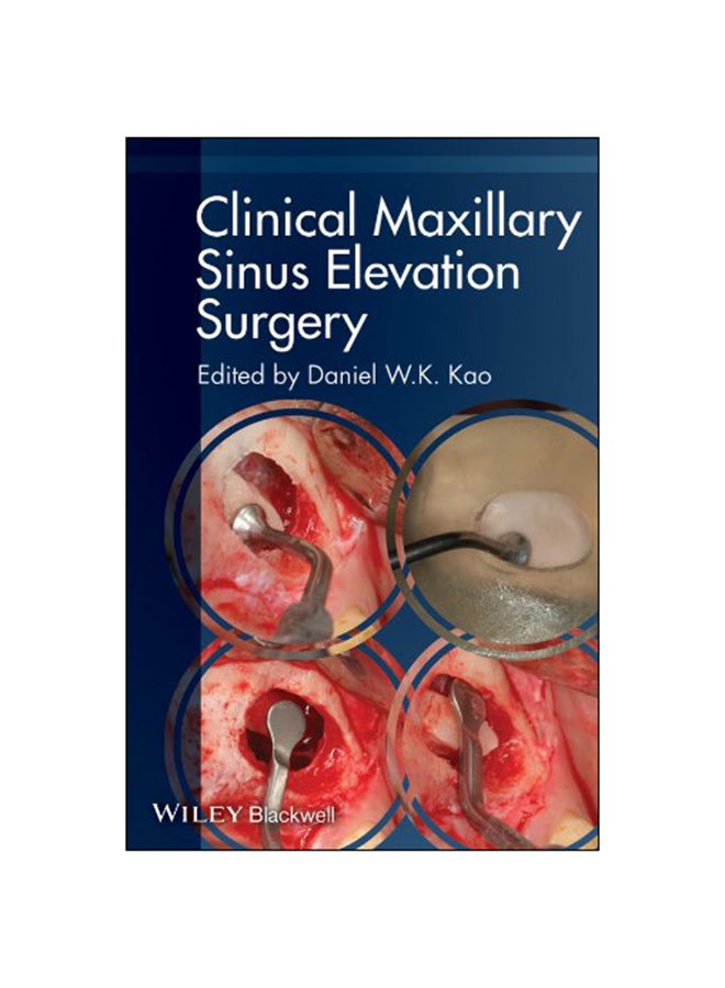 Clinical Maxillary Sinus Elevation Surgery Paperback English by Daniel W. K. Kao - 2014 