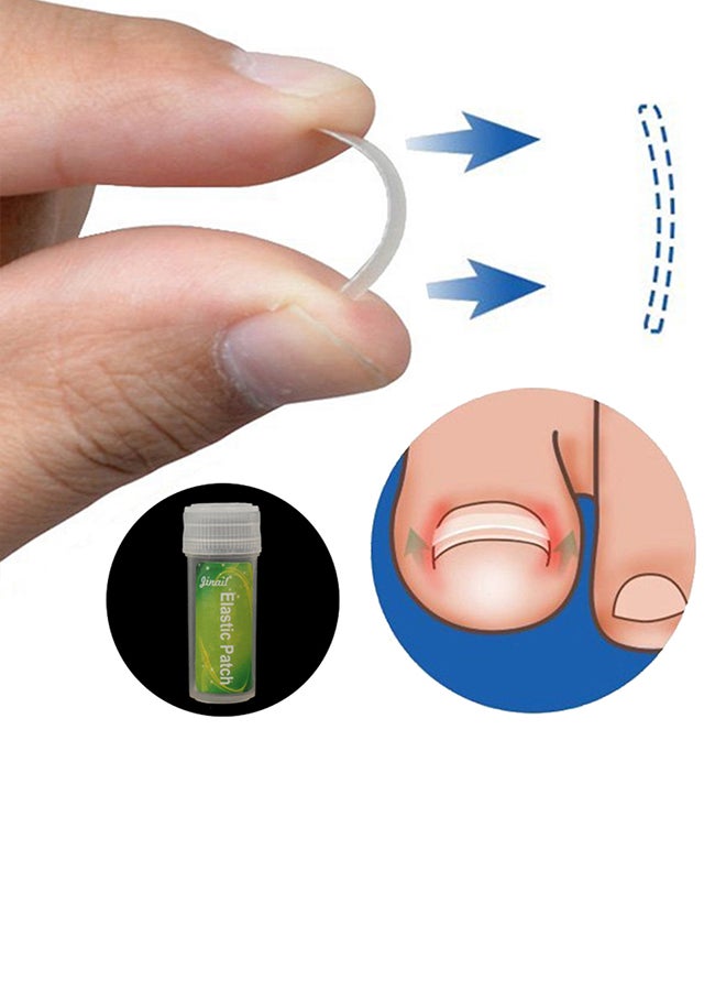 4-Piece Ingrown Toe Nail Correction Set - Image 3