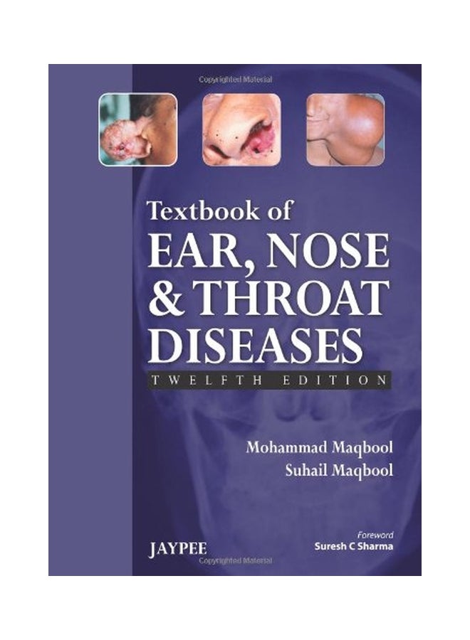 Textbook Of Ear, Nose And Throat Diseases Paperback English by Mohammad Maqbool - 01 Sep 2013 - Image 1