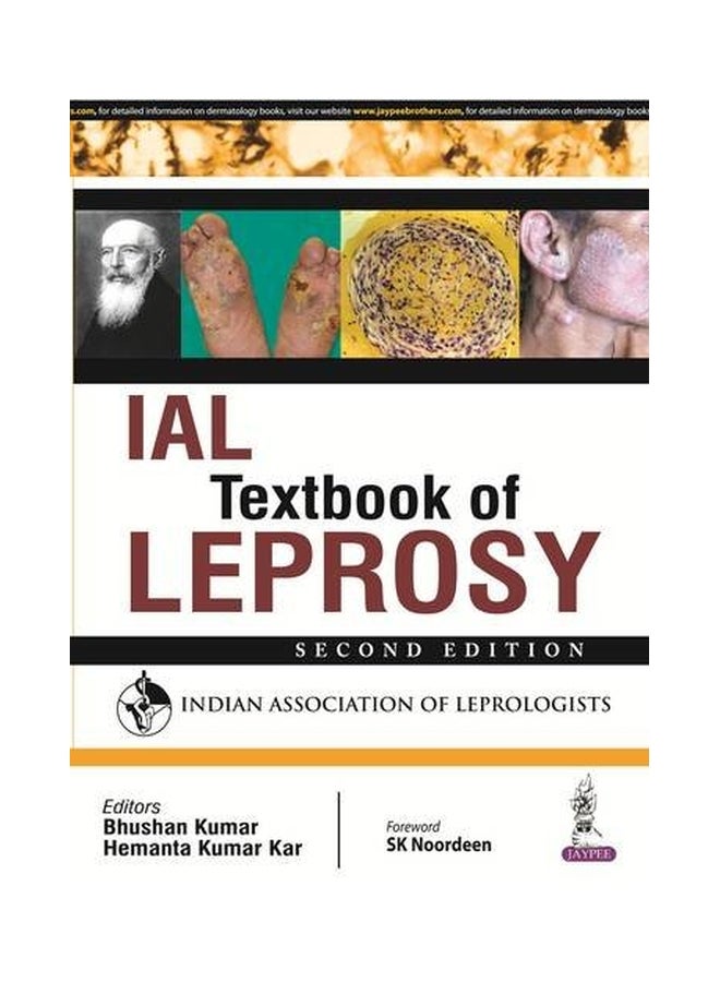 كتاب IAL عن مرض الجذام