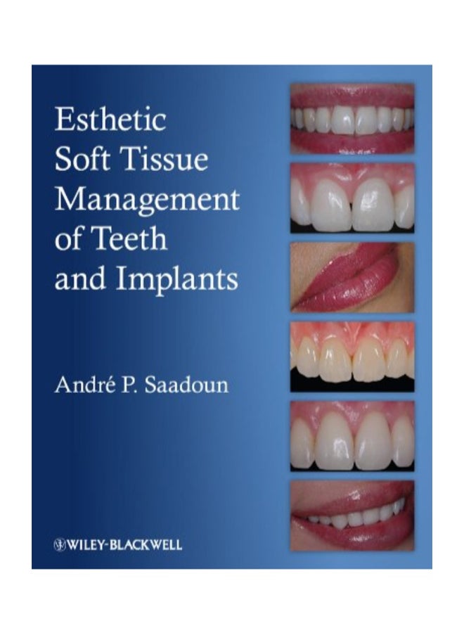 Esthetic Soft Tissue Management Of Teeth And Implants Hardcover English by Andre P. Saadoun  - Image 1