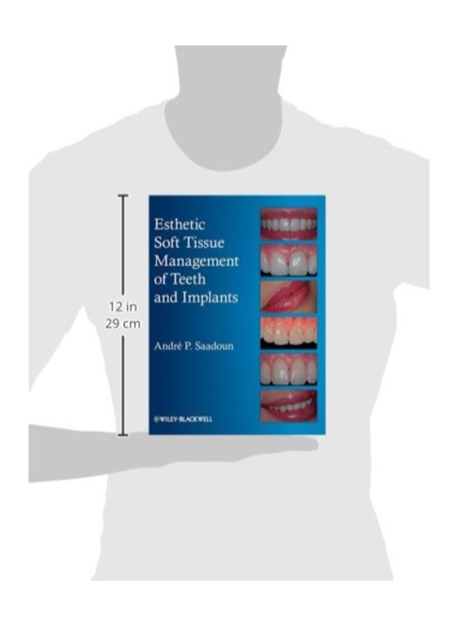 Esthetic Soft Tissue Management Of Teeth And Implants Hardcover English by Andre P. Saadoun  - Image 3