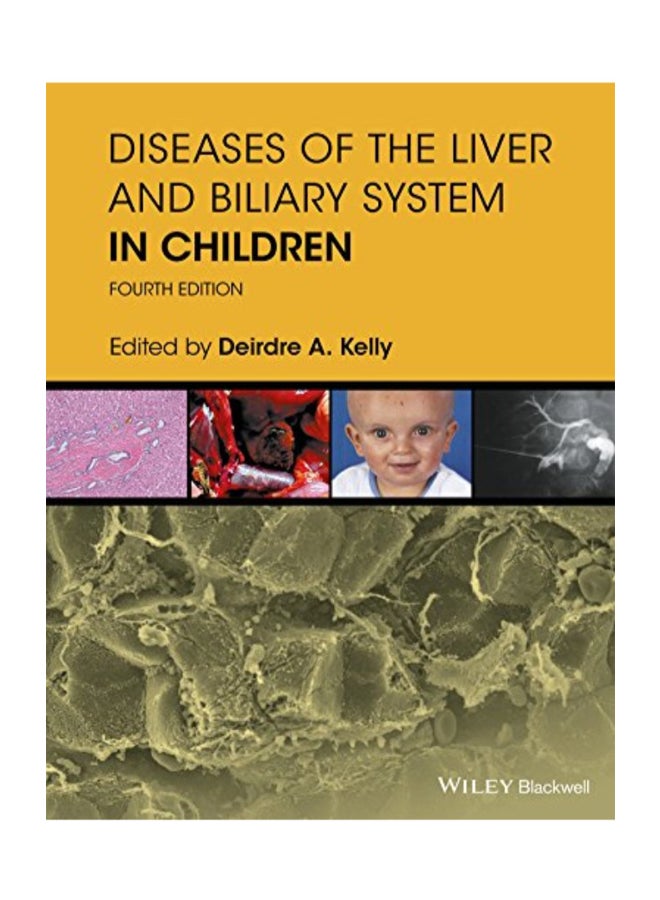 Diseases Of The Liver And Biliary System In Children hardcover english 