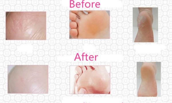 Generic - Moisturising Gel Socks - Image 1
