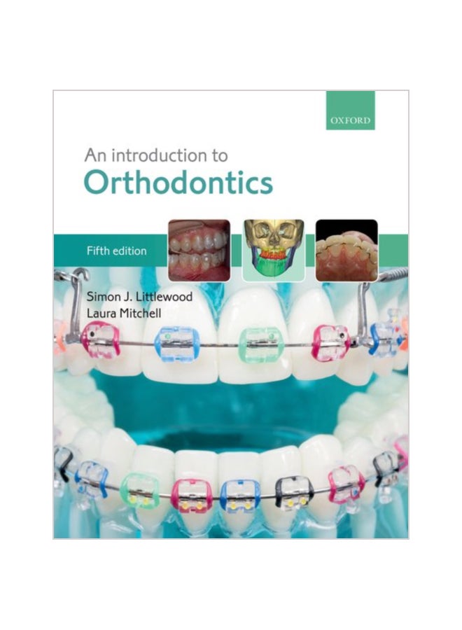 مقدمة في تقويم الأسنان