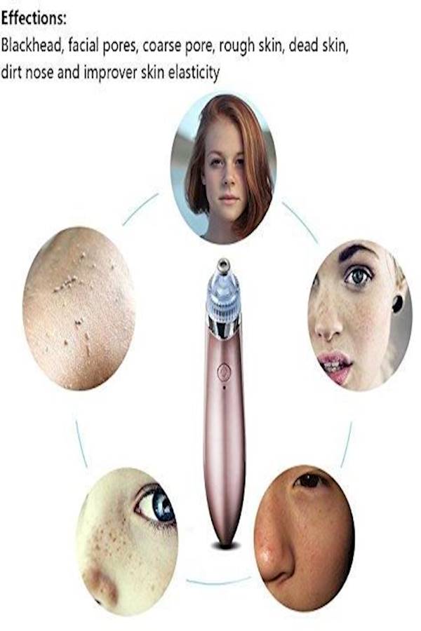 Generic - Blackhead Remover Electronic Facial Pore Cleaner Acne Vacuum - Image 1