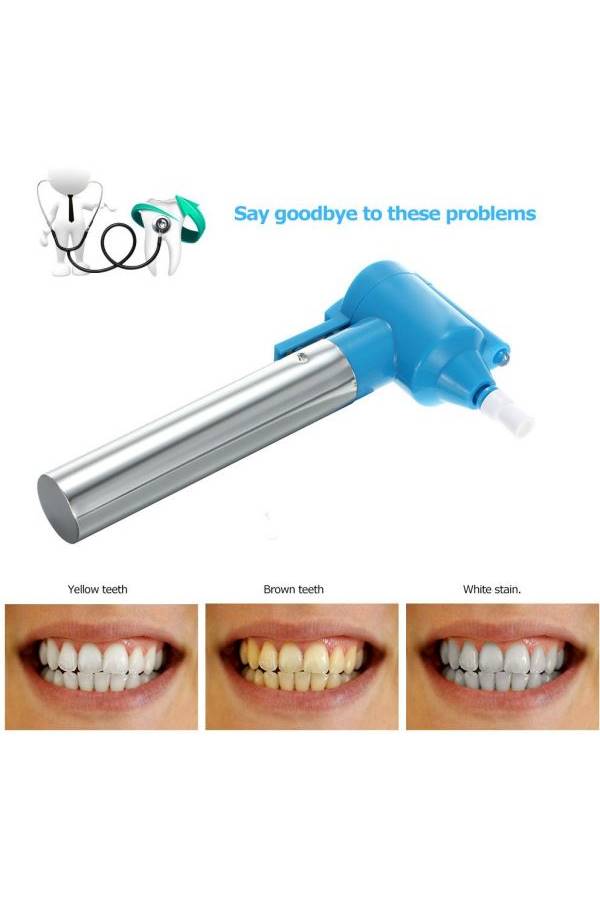 Luma Smile - Stain Removal Teeth Machine - Image 1