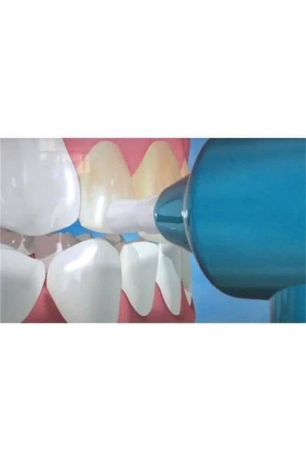 Luma Smile - Stain Removal Teeth Machine - Image 1