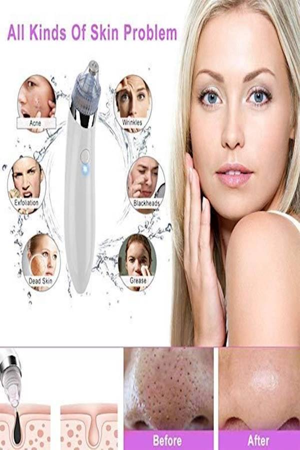 Pore Cleanser And Blackhead Remover Kit White/Silver/Clear - Image 2