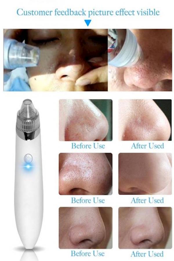 Generic Dead Skin Remover Vacuum Suction White  - Image 2