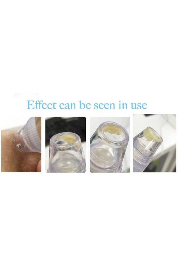 Generic Dead Skin Remover Vacuum Suction White  - Image 4