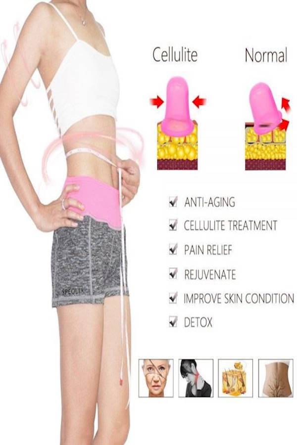 7-Piece Vacuum Massage Cups Pink - Image 5