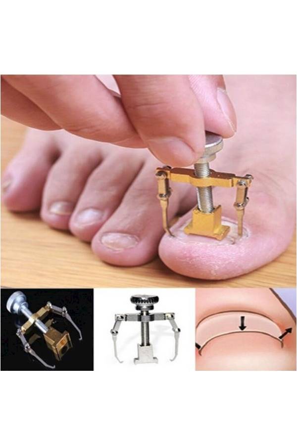 مصحح لموضع أظافر القدم فضي - Image 5