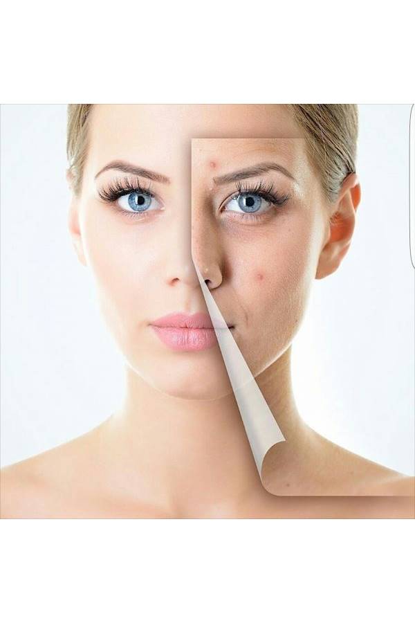 Awe - German ZGTS Micro Needle Derma Roller 0.5 mm Facial Treatment - Image 1