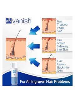 pfb vanish Chromabright Dark Spot Remover 93grams  - Image 3