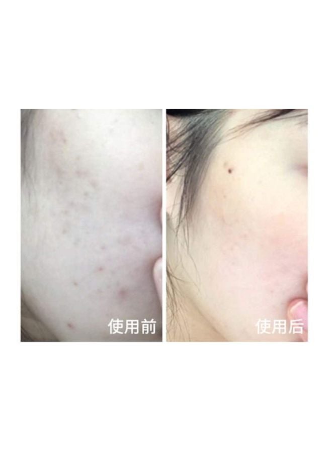 ISDIN Cicapost Isdin Post Scarring Dermatological Cream 50grams - Image 4