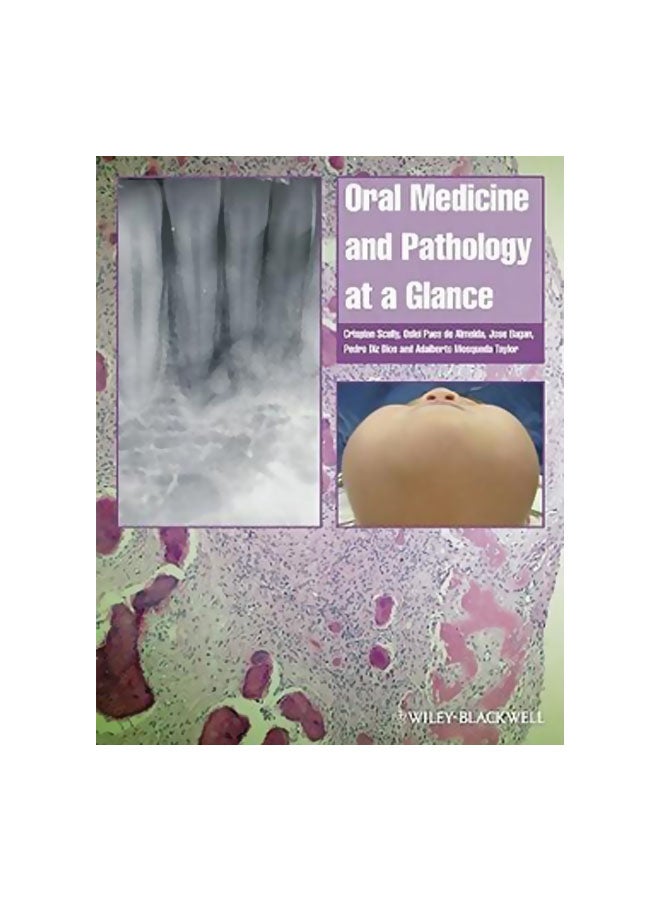 Oral Medicine And Pathology At A Glance Paperback English by Crispian Scully - 02-Jun-10