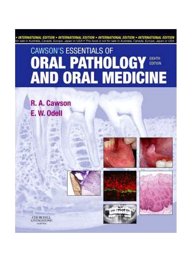 Cawsons Essentials Of Oral Pathology And Oral Medicine Paperback English by Roderick A. Cawson - 14-Feb-08 