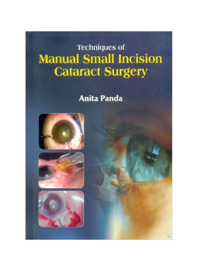 Techniques Of Manual Small Incision Cataract Surgery Hardcover English by Anita Panda - 01 Dec 2010 