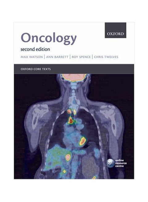 Oncology Paperback English by Max Watson - 01-Jul-07