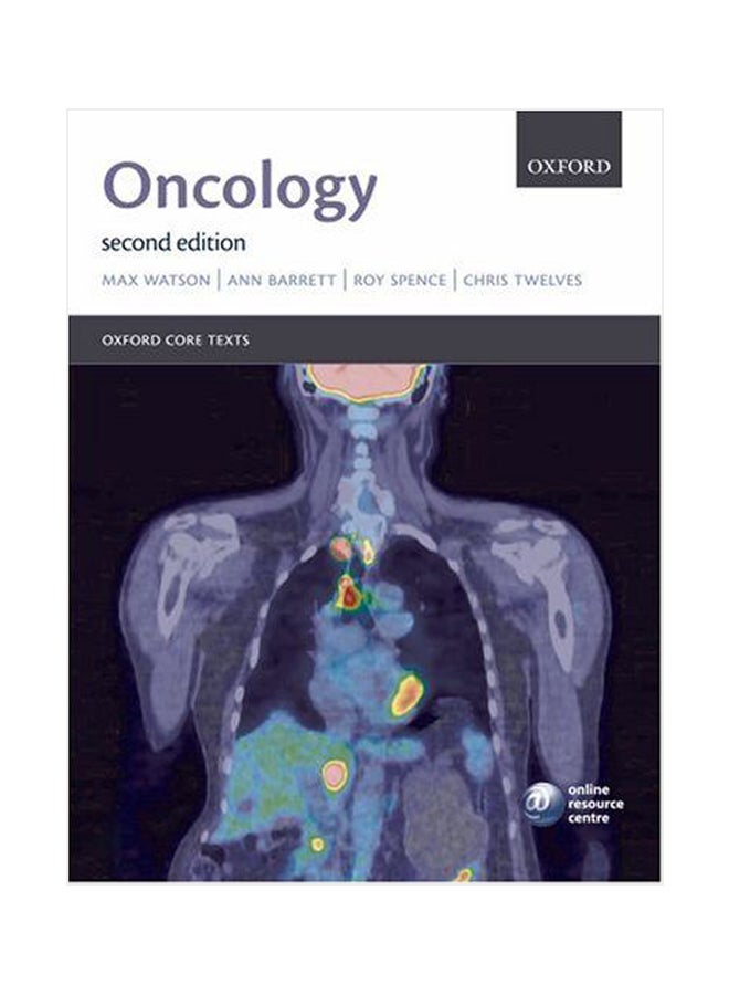 Oncology Paperback English by Max Watson - 01-Jul-07